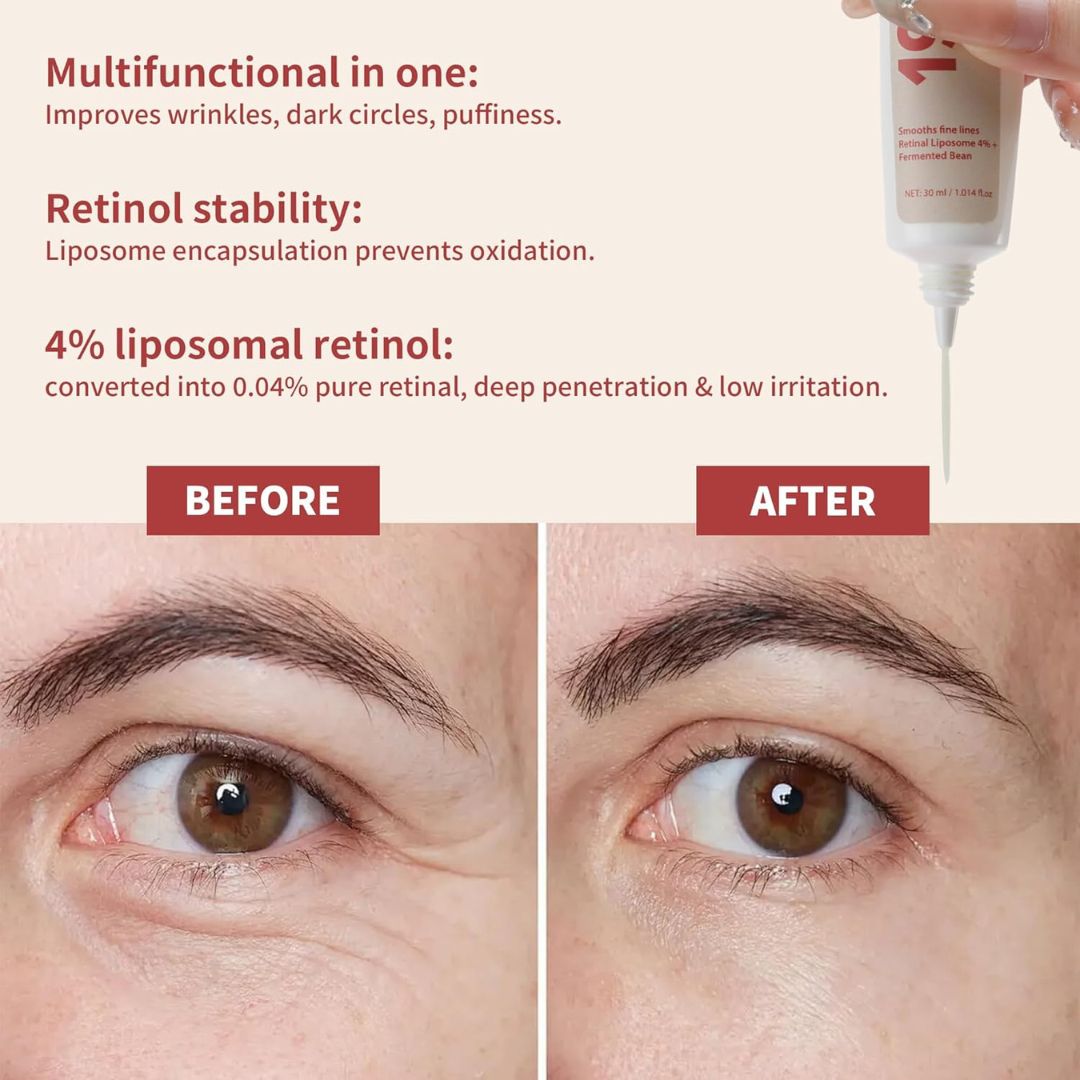 SkinReform™ Liposome